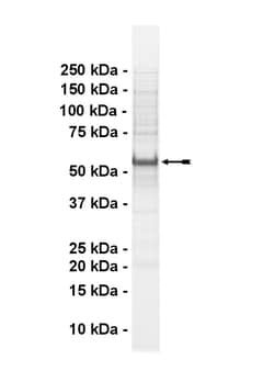 Eurofins DiscoverX DDR1 Protein, Active 250 &mu;g | Buy Online | Eurofins DiscoverX | Fisher Scientific